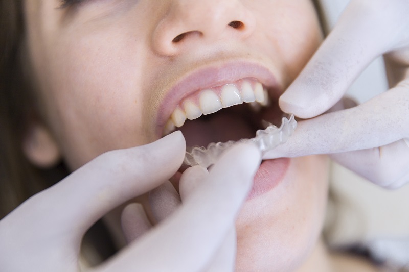 Endodoncija poreč