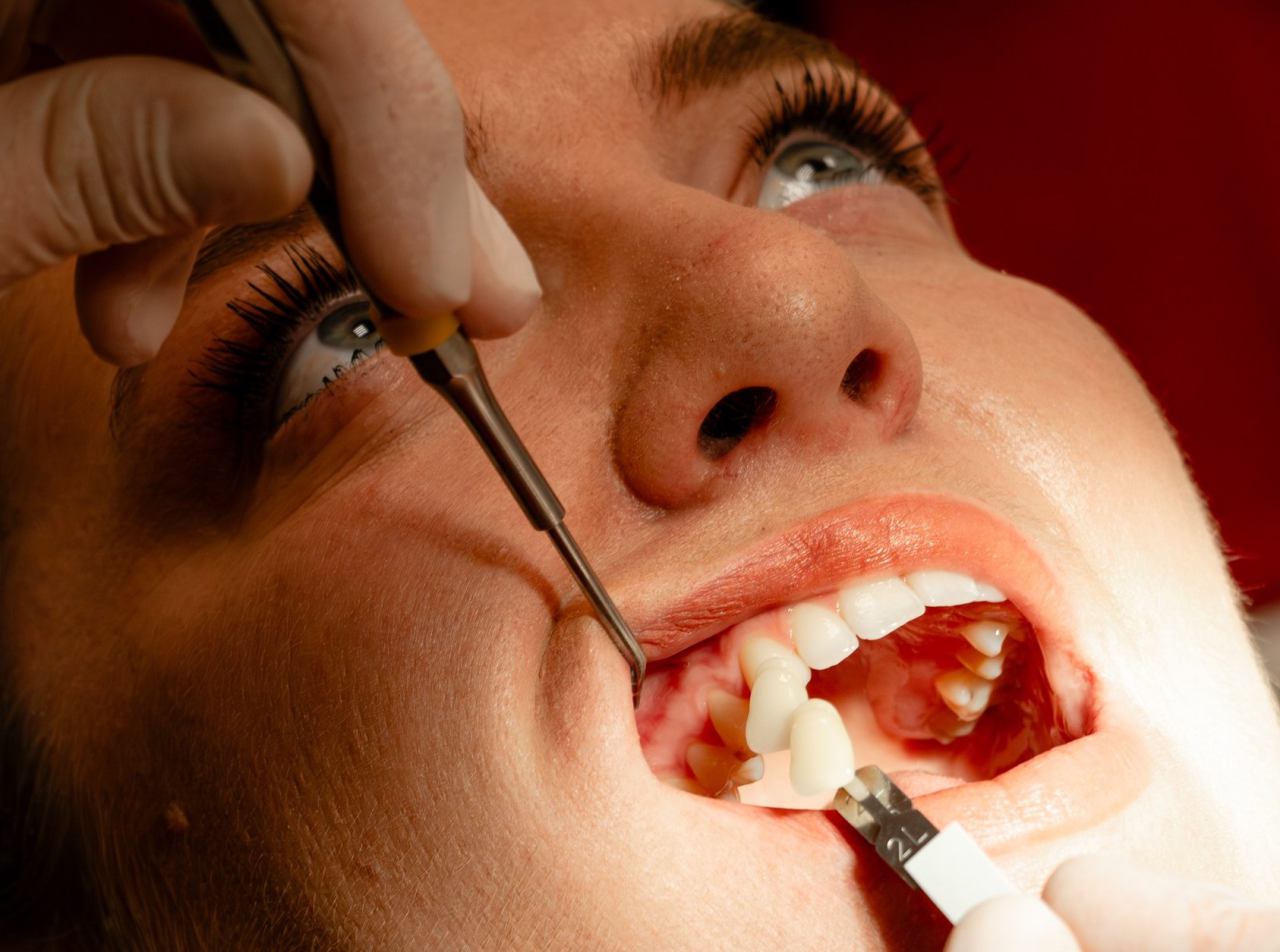 LJUSKICE I PRESS KERAMIKA