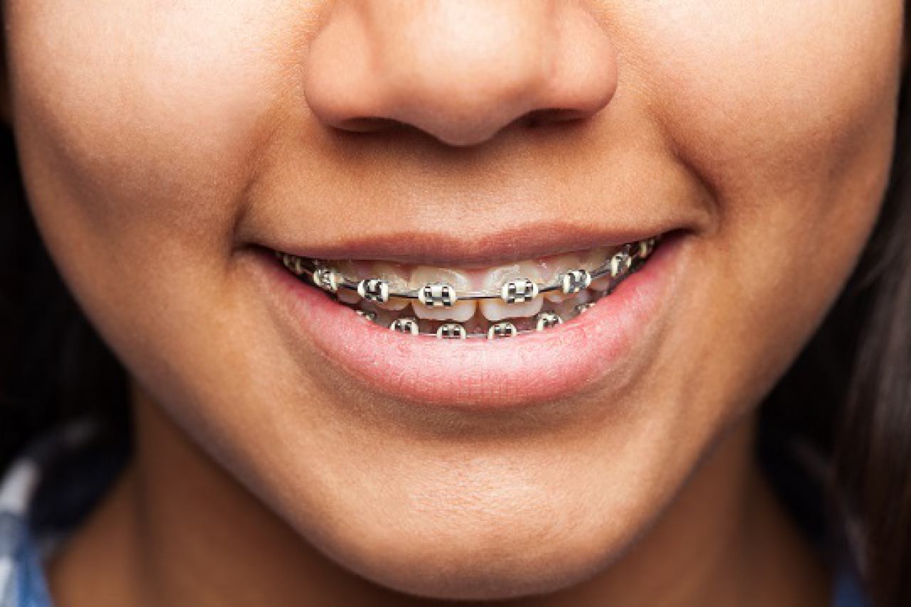 ORTHODONTIC THERAPY FOR CHILDREN AND ADULTS