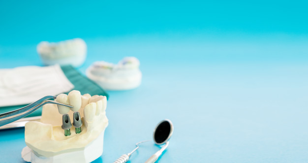 Zubni implantati, Poreč, Dental Implant Studio Dr. Rajič