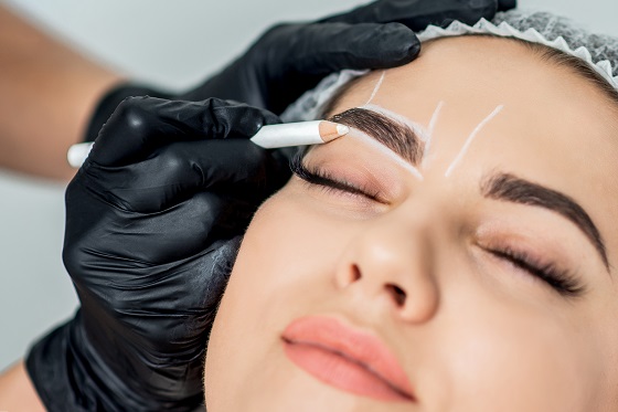 brow lift