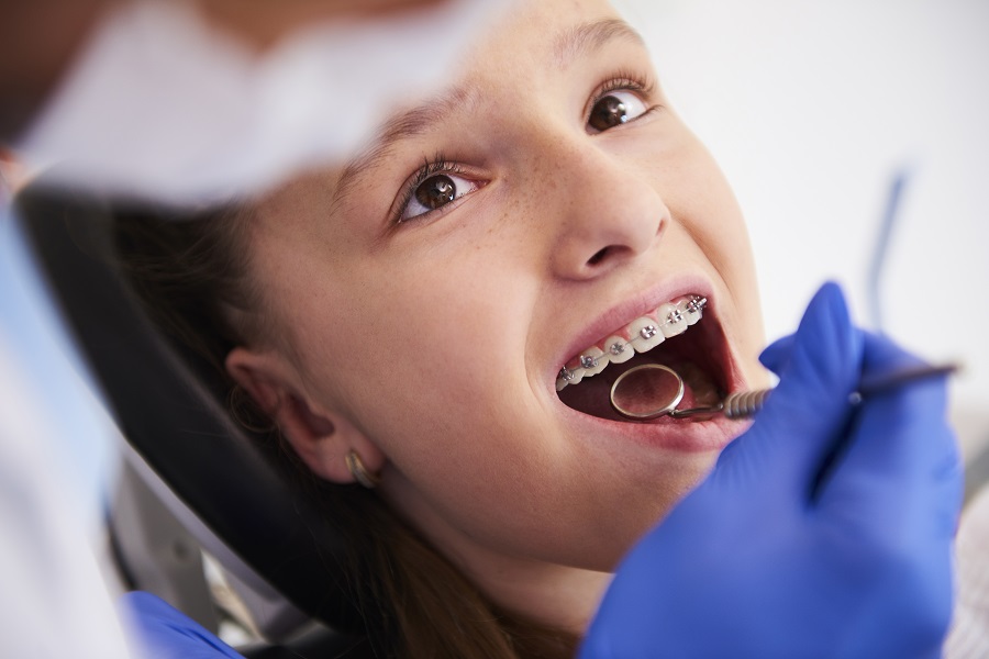 ortodoncija za djecu