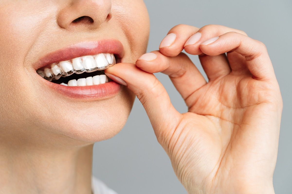 Zubnim udlagama spriječite trošenje zubi 